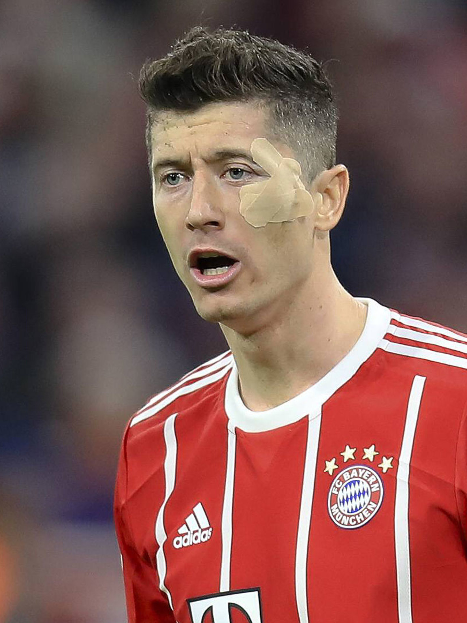 fcbカルテットは軽度の負傷 Fc Bayern Munich fcbカルテットは軽度の負傷 Fc Bayern Munich
