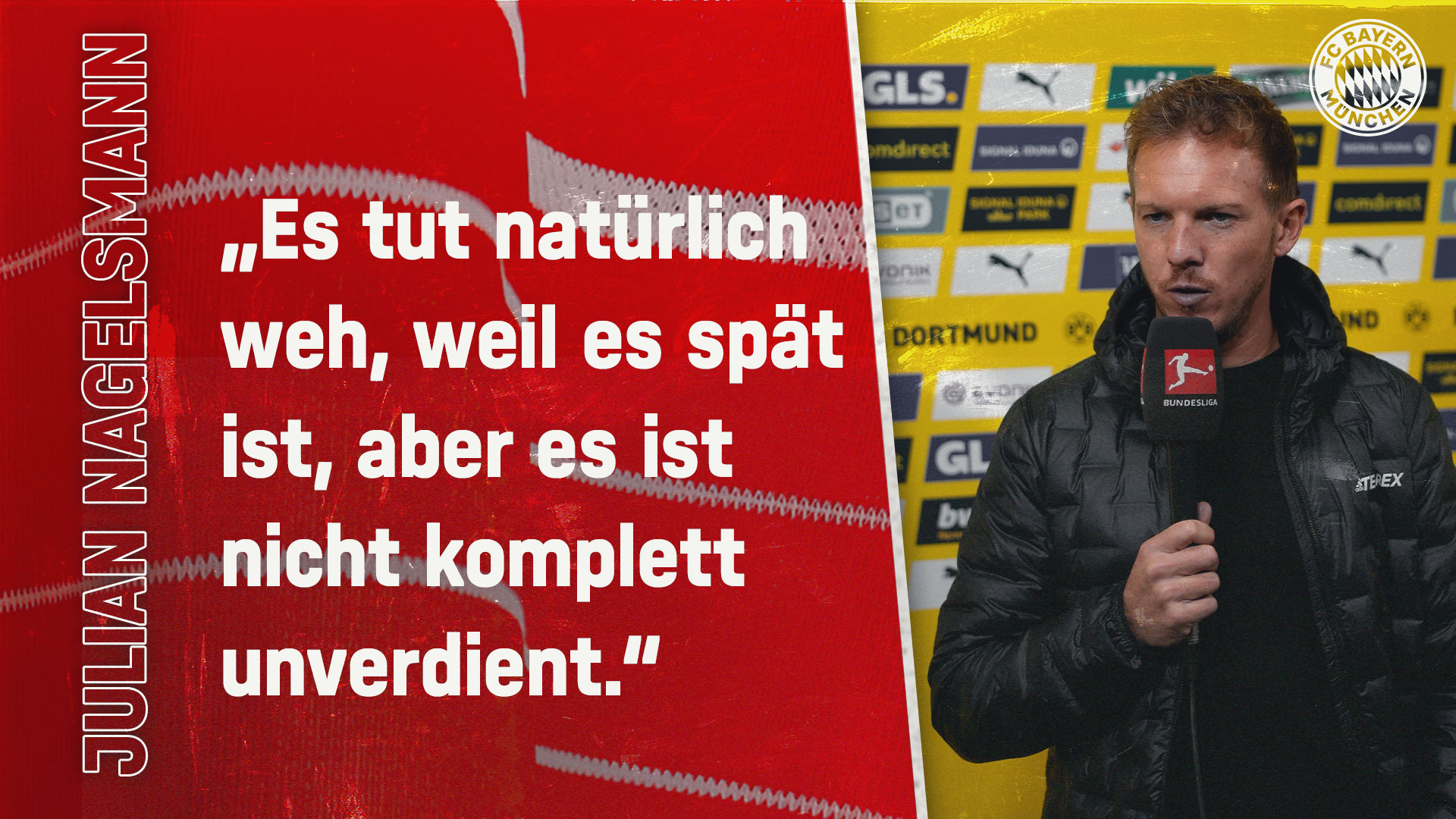 Julian Nagelsmann zum Spiel gegen Dortmund